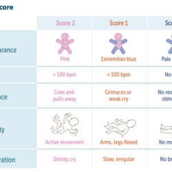 Apgar scoring birth cerebral palsy diagnosing injuries diagnostic scores indice grimace hie tone dito