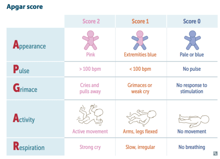 Apgar scoring birth cerebral palsy diagnosing injuries diagnostic scores indice grimace hie tone dito