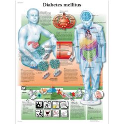 Diabetes mellitus system disorder template